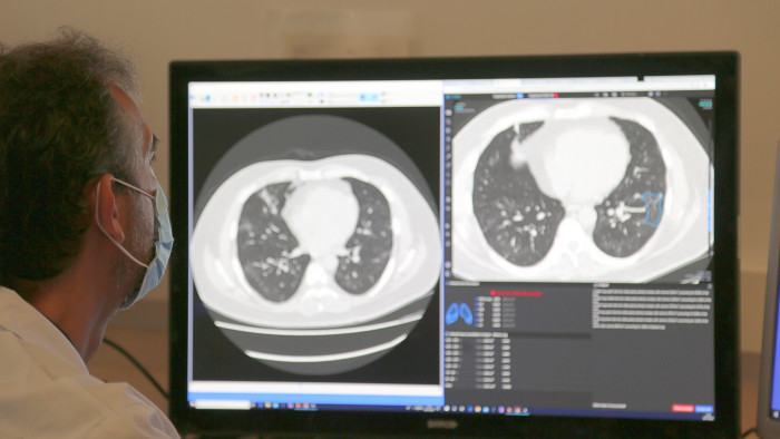 inteligencia artificial tac